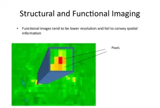 The Importance of Structural Imaging in Neuroimaging Research