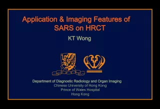 Imaging Features of SARS on High-Resolution CT: An Application in Diagnosis and Treatment Monitoring