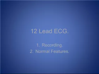 Mastering the Technique of 12 Lead ECG Recording: A Comprehensive Review
