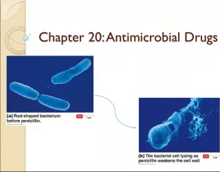 Understanding Antimicrobial Drugs and Antibiotics